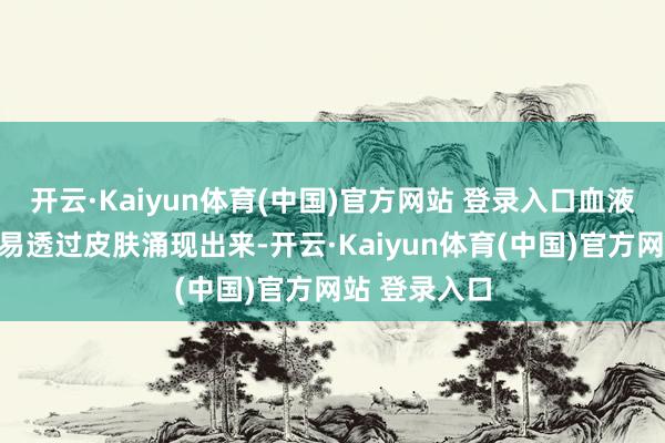 开云·Kaiyun体育(中国)官方网站 登录入口血液中的色素容易透过皮肤涌现出来-开云·Kaiyun体育(中国)官方网站 登录入口